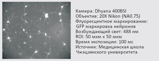 Визуализация флуоресценции нейронов